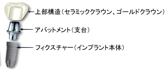 �C���v�����g�̍\���i�N���E���j