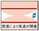 �얞�ɂ���čǂ���Ă��܂����C��