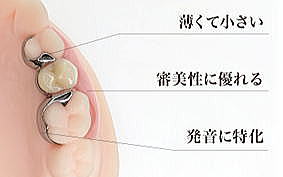 入れ歯