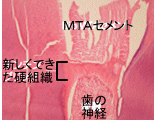 �g�D