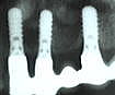 �X�N�����[�^�C�v�̃C���v�����g