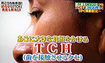 TCH
