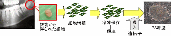 �e�m�炸���g�p�����Đ����