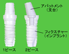 �W���R�j�A�C���v�������g�̌`��