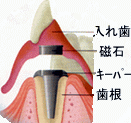���΂��g�p�������ꎕ