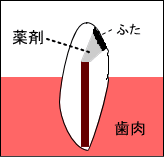 �E�H�[�L���O�u���[�`
