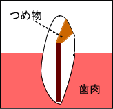 �E�H�[�L���O�u���[�`��