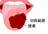 �㈟�S�E�o�p