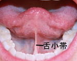 舌