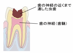 ドックベストセメント1