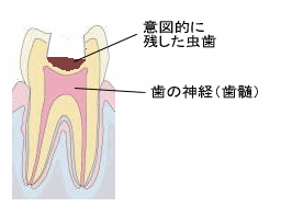 ドックベストセメント2