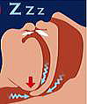 �����O�i�C�����ǂ����Ă��܂��j
