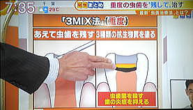 取材10