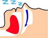 ���т��A���������ċz�ǌ�Q�̏��