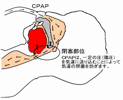 �V�[�p�b�v�g�p��